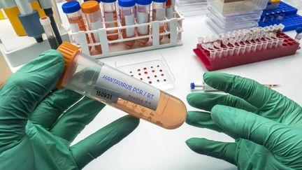 "Il ne faut pas paniquer &agrave; la moindre annonce" : face &agrave; l'hantavirus,